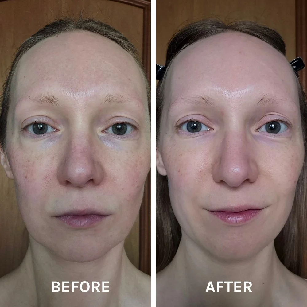 EGF + COLLAGEN RENEWAL BOOSTER